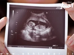 راه‌اندازی یک سامانه برای گزارش دادن «سقط جنین»