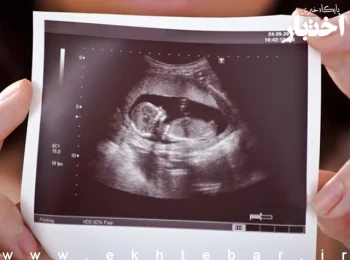 راه‌اندازی یک سامانه برای گزارش دادن «سقط جنین»