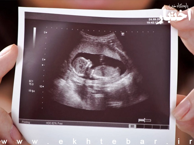 راه‌اندازی یک سامانه برای گزارش دادن «سقط جنین» - پایگاه خبری اختبار